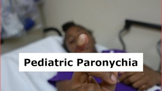 Pediatric Paronychia Drainage [upl. by Koch]