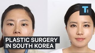 Plastic surgery in South Korea [upl. by Nivlak]