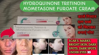 ElosoneHT cream review  Hydroquinone tretinoin Mometasone Furoate Cream  use in hindi [upl. by Aoniak]