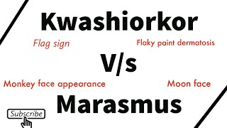 kwashiorkor marasmus Difference between kwashiorkor and marasmus [upl. by Kurr]