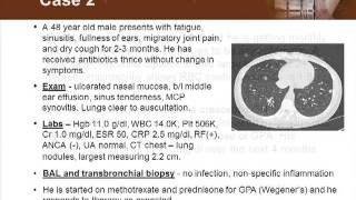 New and Emerging Treatments in Cutaneous Vasculitis [upl. by Arlynne]