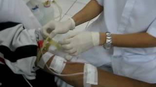 HEMODIALYSIS Procedure [upl. by Ellennaj]