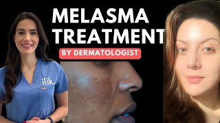 Dermatologist approved routine for Melasma  How to use hydroquinone [upl. by Everson584]