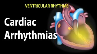 Cardiac Arrhythmias Animation [upl. by Ardine]