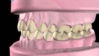 What is Orthodontics [upl. by Gough151]