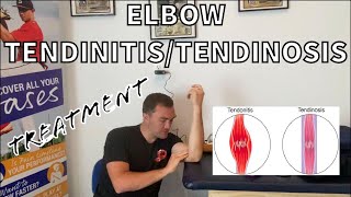 Golfers Elbow Medial Epicondylitis Tendonitis and Tendinosis Treatment [upl. by Doak690]