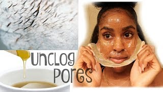 DIY Milk Peel Off Mask UNPLUG Blackheads Whiteheads amp Unwanted Hair [upl. by Birkner27]