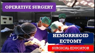 HEMORRHOIDECTOMYSTEP BY STEP OPERATIVE SURGERY [upl. by Natehc]