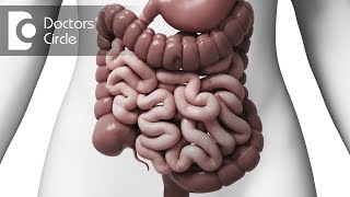 What is Intussusception in adults  Dr Nagaraj B Puttaswamy [upl. by Mordecai]