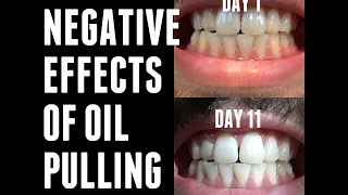 OIL PULLING EXPERIMENTS  NegativeSide Effects  Day 11 [upl. by Aisad]