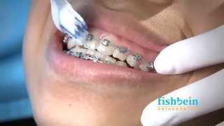 Orthodontic Home Care Instructions  Braces  Brushing [upl. by Fairfield]