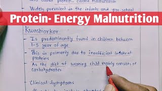 Protein  Energy Malnutrition  Kwashiorkor  Marasmus  Biochemistry [upl. by Corotto]