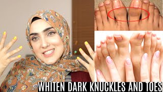 HOW TO BRIGHTEN HANDSFEET AND LIGHTEN KNUCKLESTOES IN URDU STEP BY STEP ROUTINE Immy [upl. by Neona]