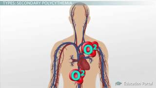 Polycythemia Definition amp Causes [upl. by Zenger]