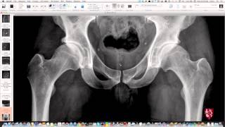 Pelvis and Hips Essential Radiography Repost [upl. by Dev]