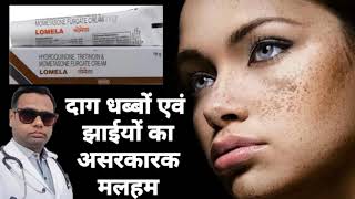 Ointment for melasma। Lomela ointment review Hydroquinone Tretinoin amp Mometasone cream। uses। [upl. by Almeida984]