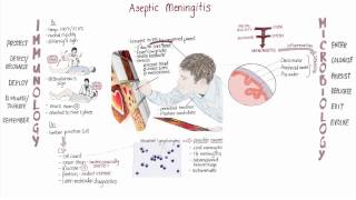 Enterovirus Meningitis Springboard [upl. by Egiarc]