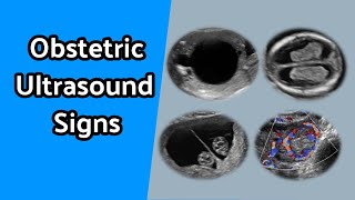 Obstetric Ultrasound Signs [upl. by Vilma]