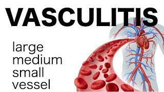 Vasculitis [upl. by Pinsky161]