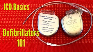 Defibrillators 101  The Basics Of An Implantable Cardioverter Defibrillator ICD [upl. by Nimsay702]