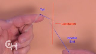 Surgical Sliding Knot Step by Step Technique [upl. by Nerrat]