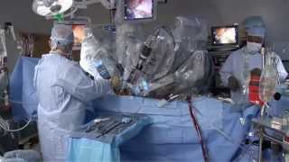 Laparoscopic vs Robotic [upl. by Adok]