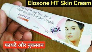 Elosone HT Skin Cream Ke Fayde Or Nuksan  Hydroquinone Tretinoin amp Mometasone Furoate Cream [upl. by Yehs530]