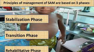 Severe Acute Malnutrition Part 14  Appetite test  Pediatrics [upl. by Toiboid]