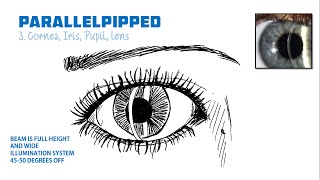 Slit Lamp Exam and Techniques [upl. by Eitsym70]