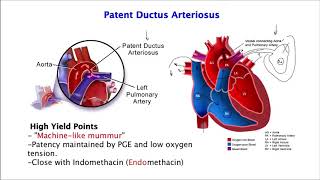 Heart SoundsPatent Ductus Arteriosus [upl. by Levram]