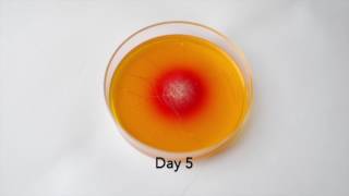 DTM Fungal Culture Growth of Ringworm [upl. by Michi]