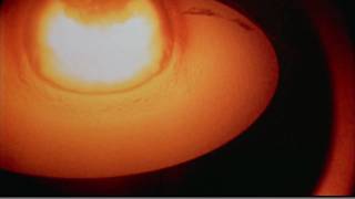 Castle Bravo  Huge thermonuclear explosion [upl. by Bullivant]