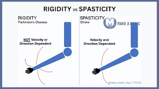 Rigidity vs Spasticity Explained [upl. by Borman962]