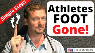 How Should Athletes Diet  Sports Nutrition For Athletes [upl. by Kirima596]