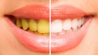 How To Whiten Your Teeth [upl. by Backler]