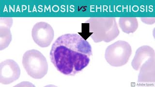 Anaplasmosis vs Ehrlichiosis Anaplasma phagocytophilum vs Ehrlichia chaffeensis amp ewingii [upl. by Tate]