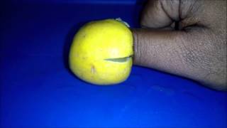 how to remove pus from fingers  Paronychia [upl. by Zetrok]