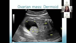 Introduction to 1st Trimester Pregnancy Ultrasound [upl. by Primrosa]