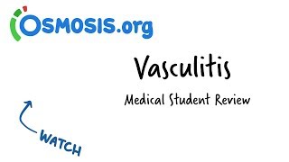 Temporal Arteritis  Vasculitis Mnemonic [upl. by Gonzalez350]