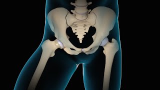 Prep and Drape for Total Hip Arthroplasty [upl. by Rednirah]