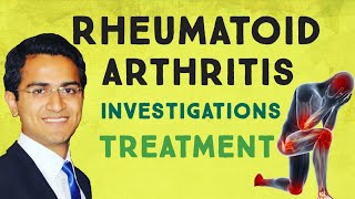 Rheumatoid Arthritis Diagnosis amp Treatment  Dr Dhaiwat Shukla [upl. by Akenahs332]