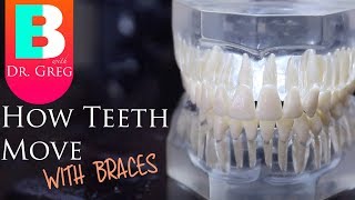 BRACES EXPLAINED How Teeth Move  Braces Work [upl. by Freud139]