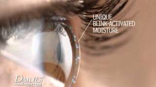 DAILIES® AquaComfort Plus® Contact Lenses [upl. by Truitt395]