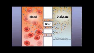 Hemodialysis Hemofilter and countercurrent animation [upl. by Angell67]