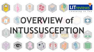 Overview of Intussusception [upl. by Wellesley]