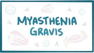 Myasthenia gravis  causes symptoms treatment pathology [upl. by Thomasina]