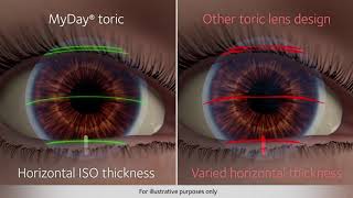 Upgrade your Astigmatic Patients to MyDay® toric [upl. by Lowenstern99]