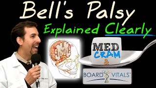 Bells Palsy Explained Clearly  Exam Practice Question [upl. by Renard]