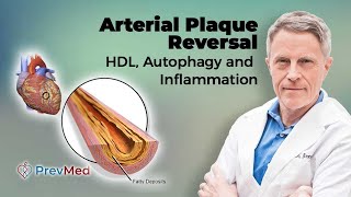 Arterial Plaque Reversal HDL Autophagy amp Inflammation [upl. by Odrick]