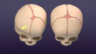 Cranial Nerves Part 1 [upl. by Atinod970]